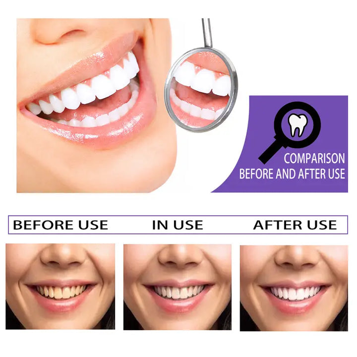 Tooth Whitening Toothpaste for Stain Removal and Brightening