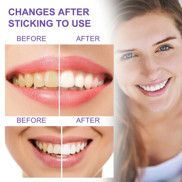 Tooth Whitening Toothpaste for Stain Removal and Brightening